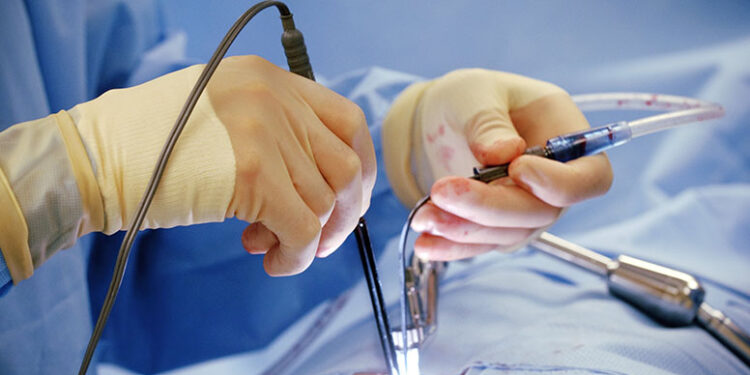 The Role of Advanced Technology and Skilled Surgeons in Successful Cardiovascular Surgery